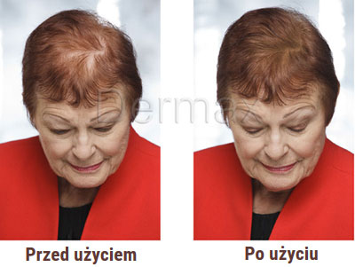 Dermax Hair Fibers efekt 2